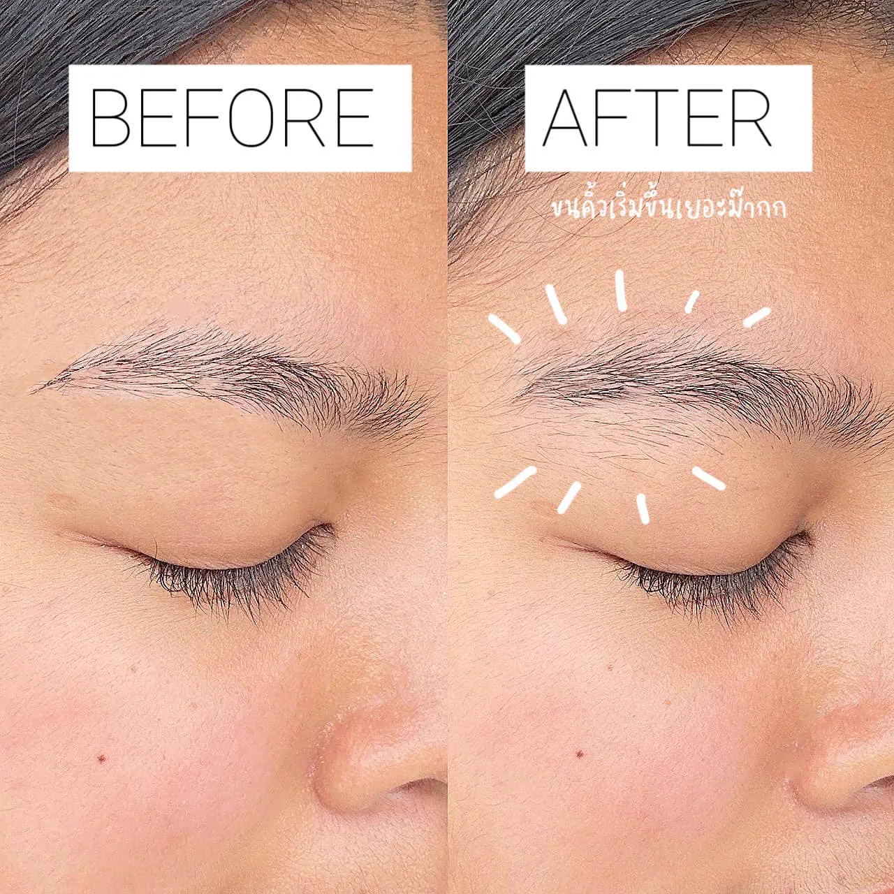 หลังจากที่ได้ลองใช้ AloEx Cute Eyebrow Nourisning Cream ผลลัพธ์ที่เห็นเลยคือคนคิ้วอ่อนๆ งอกขึ้นเยอะมาก