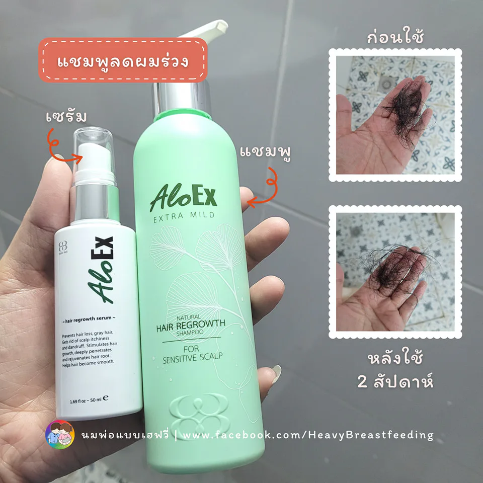 ใช้ต่อเนื่องประมาณ 2 สัปดาห์ร่วมกับเซรั่ม …เทียบผมที่ร่วง ใช้ครั้งแรกจนถึงครั้งล่าสุด ผมร่วงน้อยลงจริงๆค่ะ เลิศสมากกก