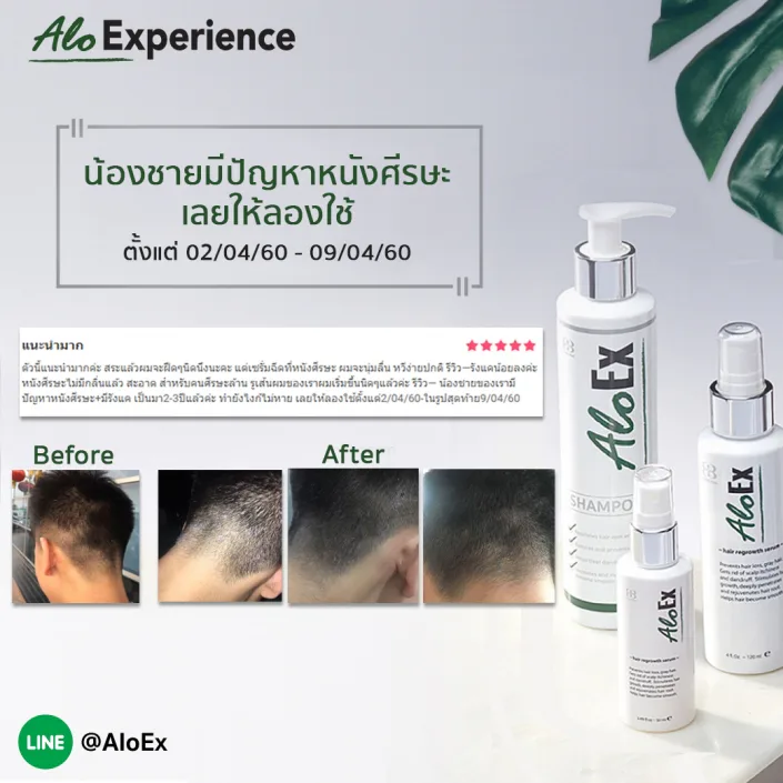 น้องชายมีปัญหาหนังศีรษะเลยให้ลองใช้