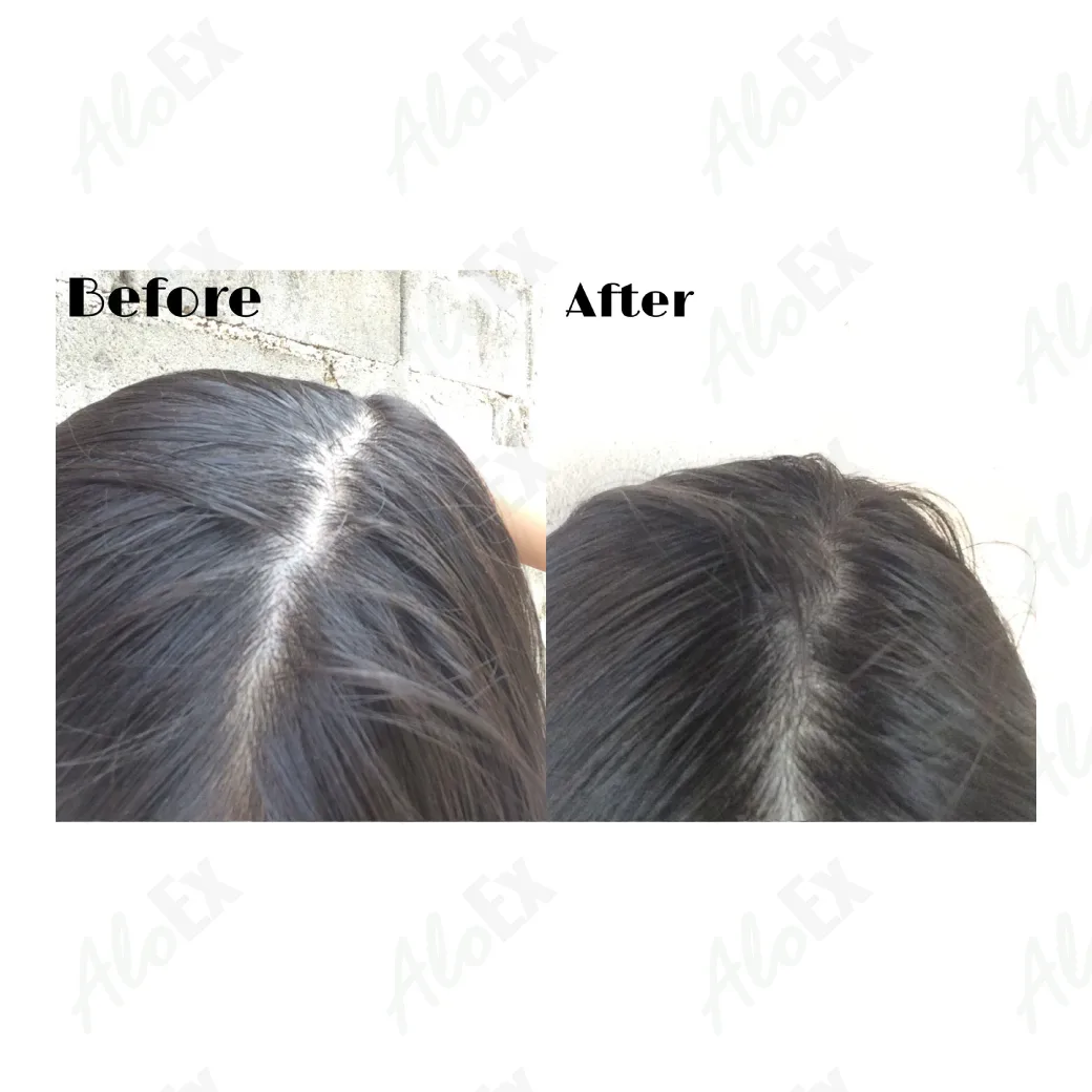 รีวิวก่อนใช้-หลังใช้ ผลิตภัณฑ์ AloEx