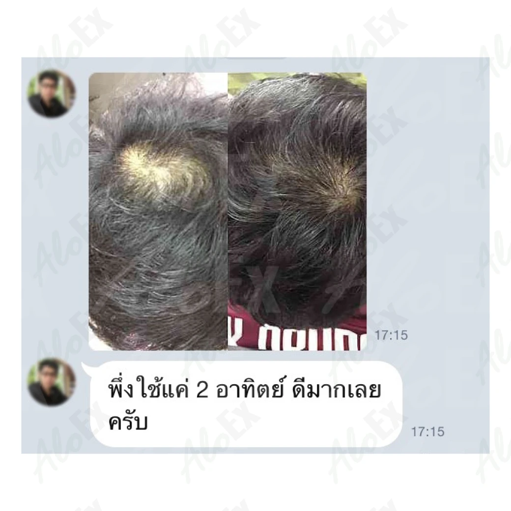 ใช้เพียง 2 อาทิตย์