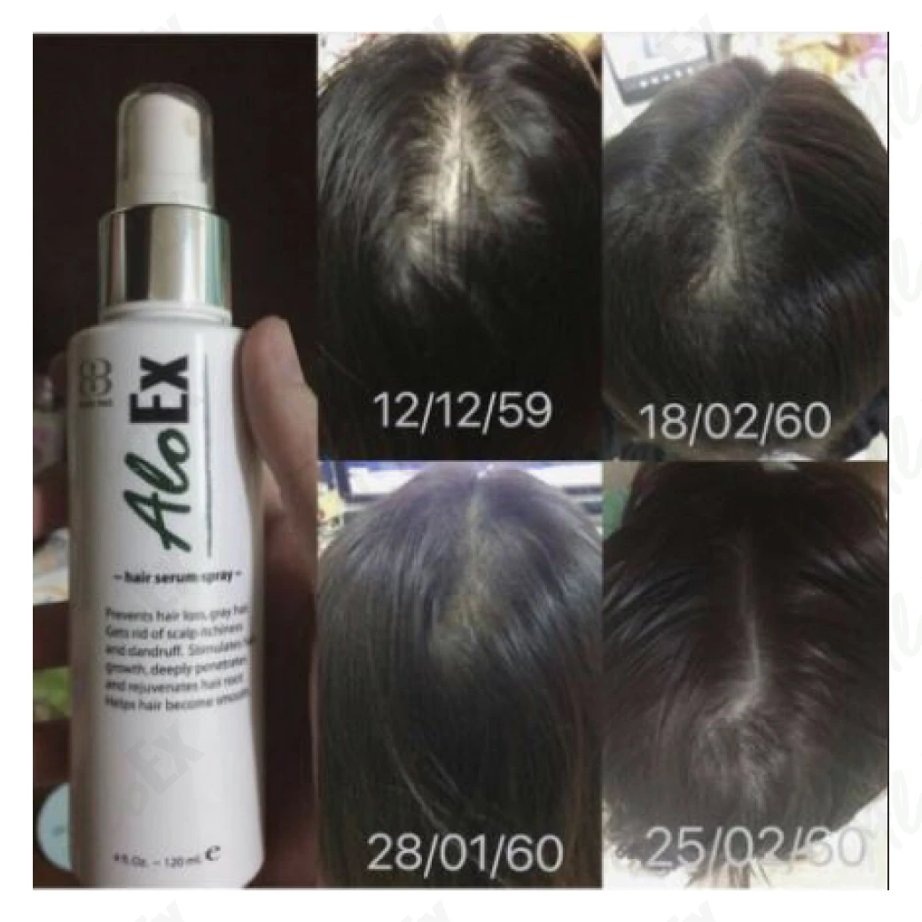 รีวิวก่อนใช้-หลังใช้ เซรั่ม AloEx